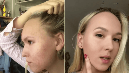 Skincare with sensitive skin in mind | OMIANA